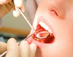 Dental Health Risks For  Partially Erupted Wisdom Teeth