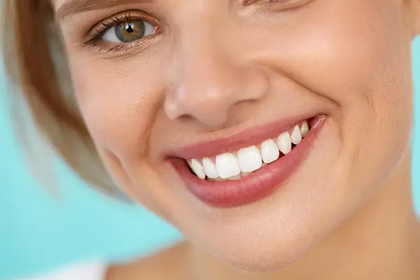 A close-up of a woman's perfect smile with bright white teeth, illustrating the benefits of professional cosmetic dentistry.