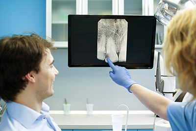 What Are Digital Dental X-Rays